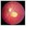 Childhood Eye Disease Signs